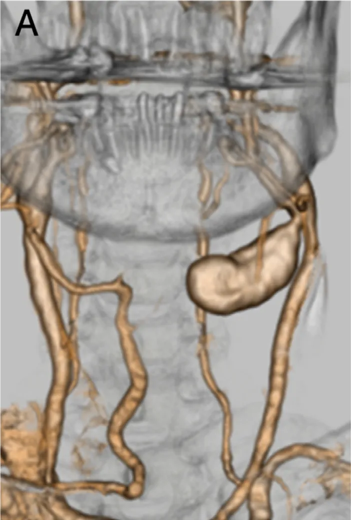 “就打了个喷嚏，竟险些让我付出生命的代价！”