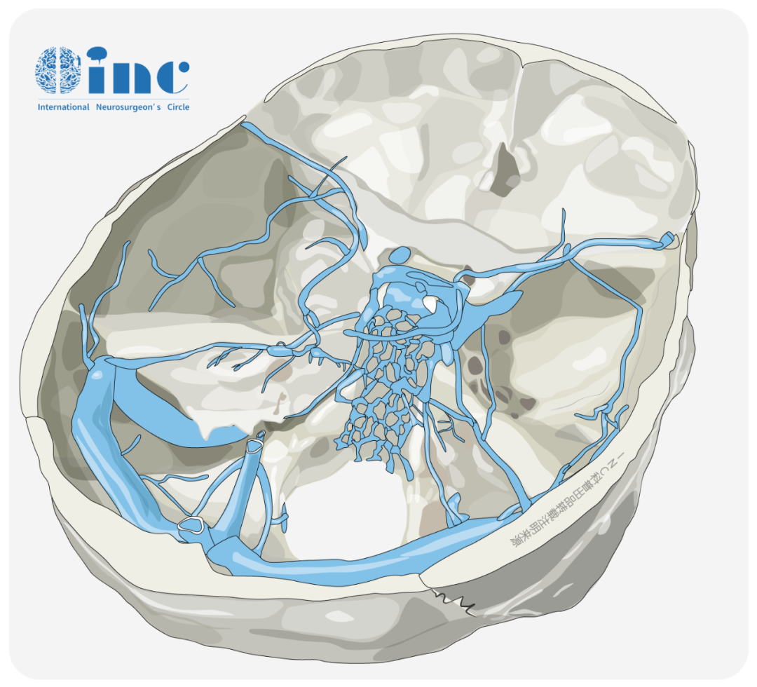 10大内镜颅底手术中颅底缺损重建技术：13个国家40个学术机构的68位专家分享