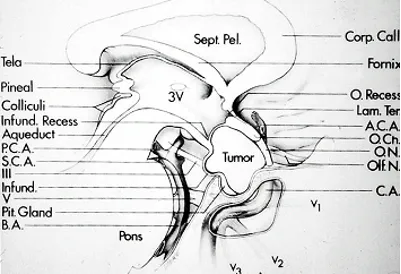 分类：基于不同体系