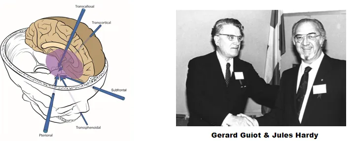 Henry W.S.Schroeder教授