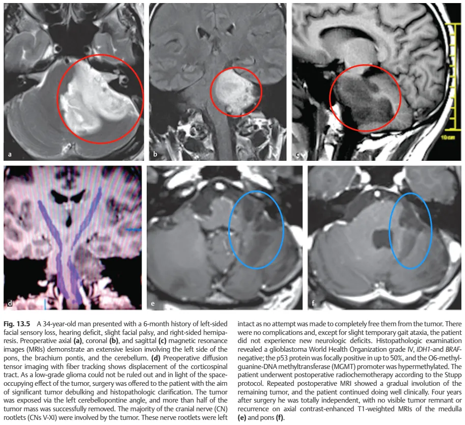 INC巴教授文章中的该案例截图