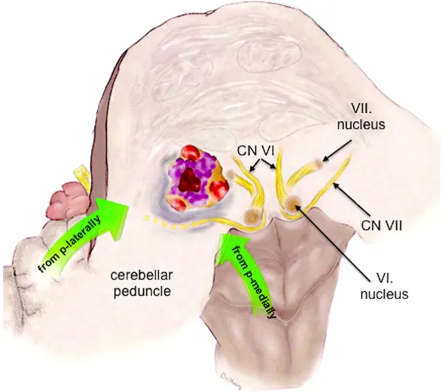 脑桥中部的横断面
