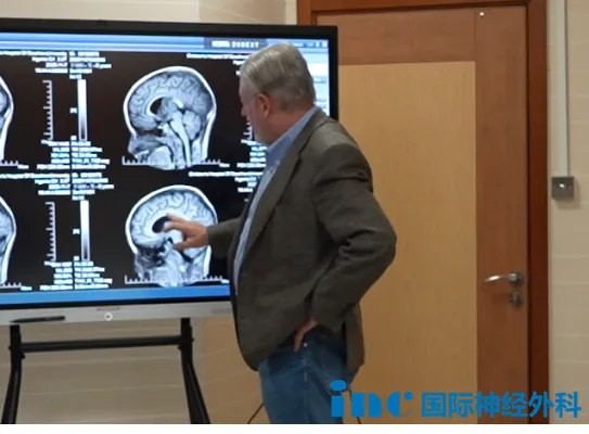 “一切为了孩子！”疑难脑瘤家庭期盼中，INC巴教授示范手术继续