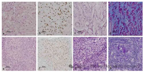 图1.部分患者的病理切片示例