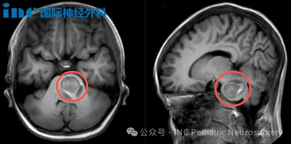 身为医者,这一次他要救的竟是脑干出血的女儿……