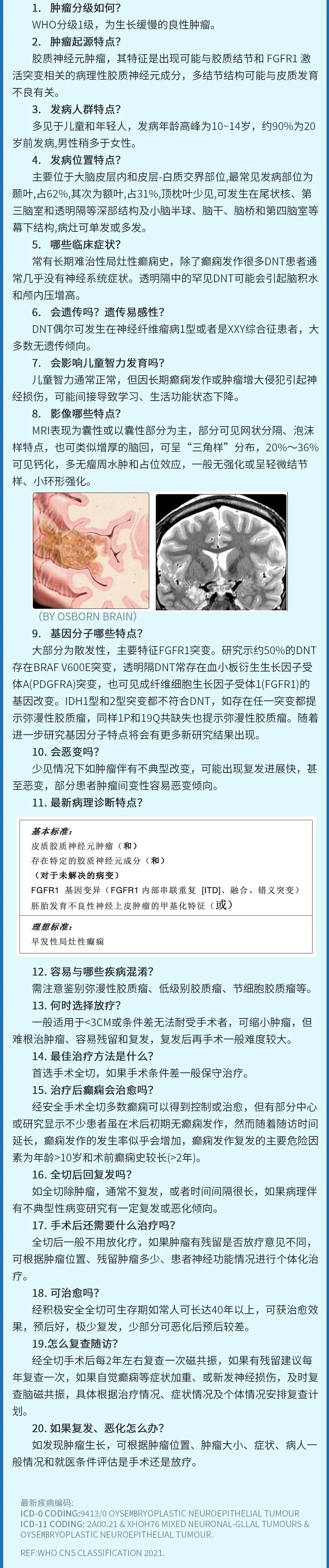 DNET胚胎发育不良性神经上皮肿瘤