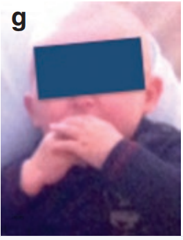 （图g）