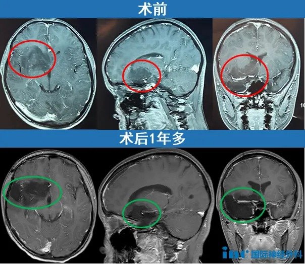 术前术后影像资料