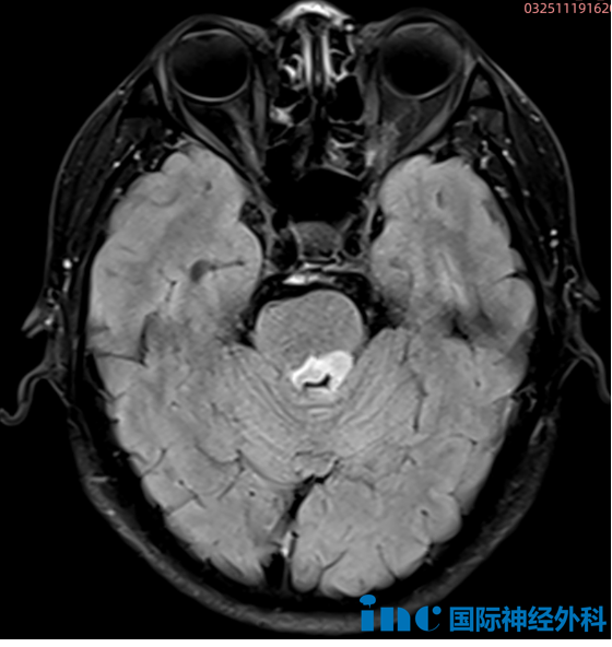 “巴教授可以尽快为我手术吗？”12月下旬，他们与德国神外大咖携手奔赴“生命之约”