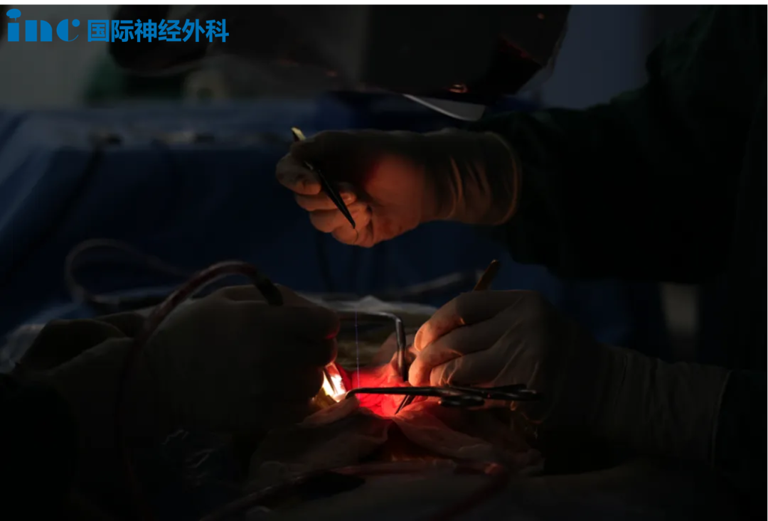 2型神经纤维瘤病