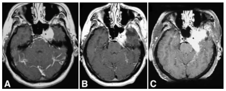 图2.48岁男性患者，表现为眼肌麻痹伴面部感觉减退，磁共振影像显示肿瘤进展