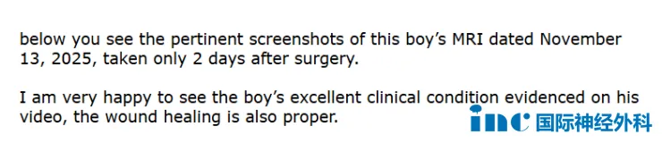 巴教授随访报告截取