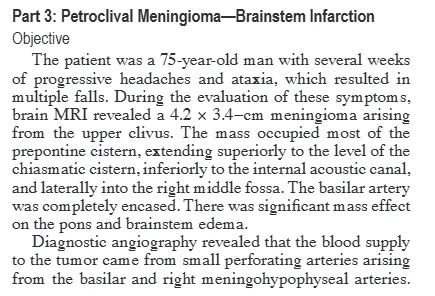 岩斜区脑膜瘤案例