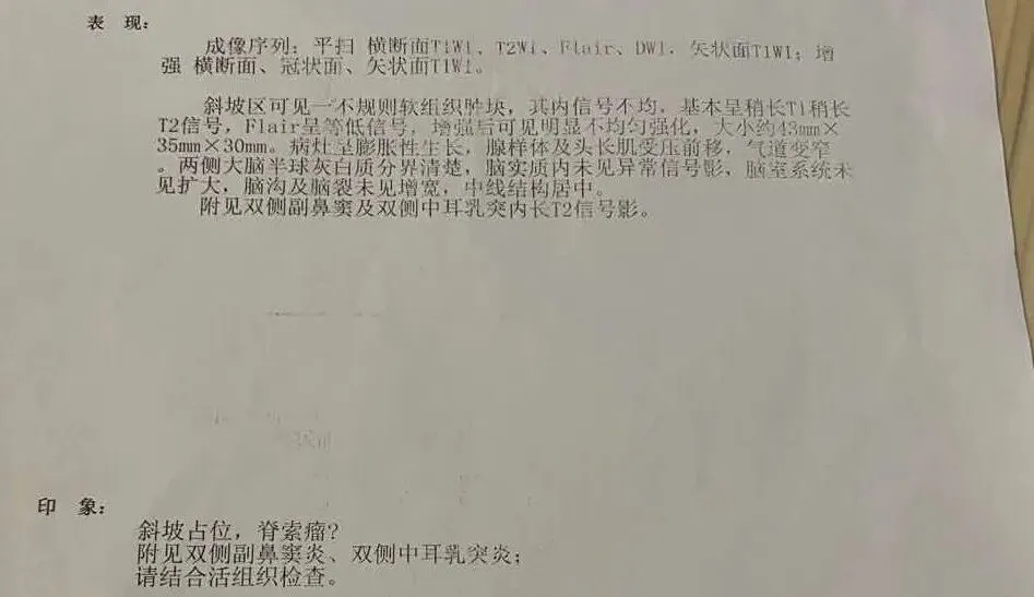枕骨斜坡区骨质破坏，需鉴别朗格汉斯细胞组织增生症（LCH）或脊索瘤的可能