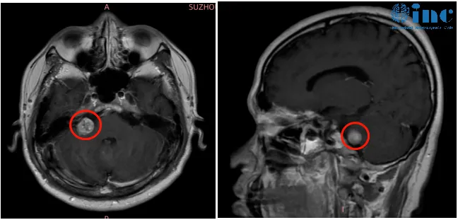 35岁高校老师的“保面保听”之战