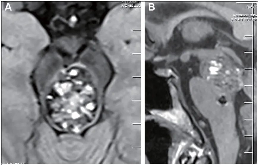 术前：轴位和矢状位增强磁共振成像