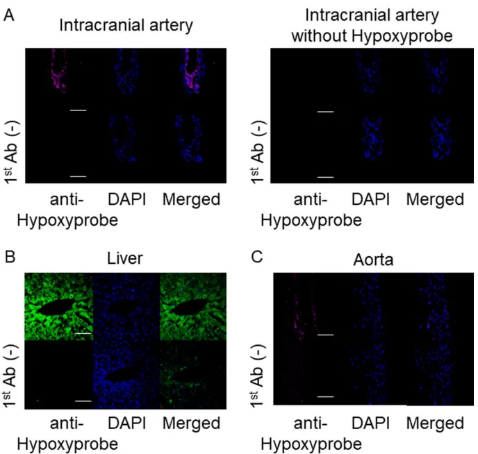 Hypoxyprobe检测显示,颅内动脉外膜细胞呈缺氧阳性(图A),肝脏中央静脉周围细胞作为阳性对照(图B),而主动脉仅见稀疏信号(图C),证实颅内动脉外膜缺氧的独特性。