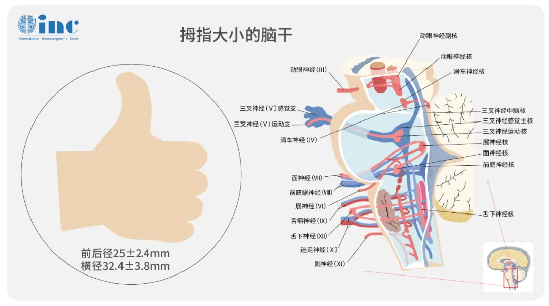脑干示意图