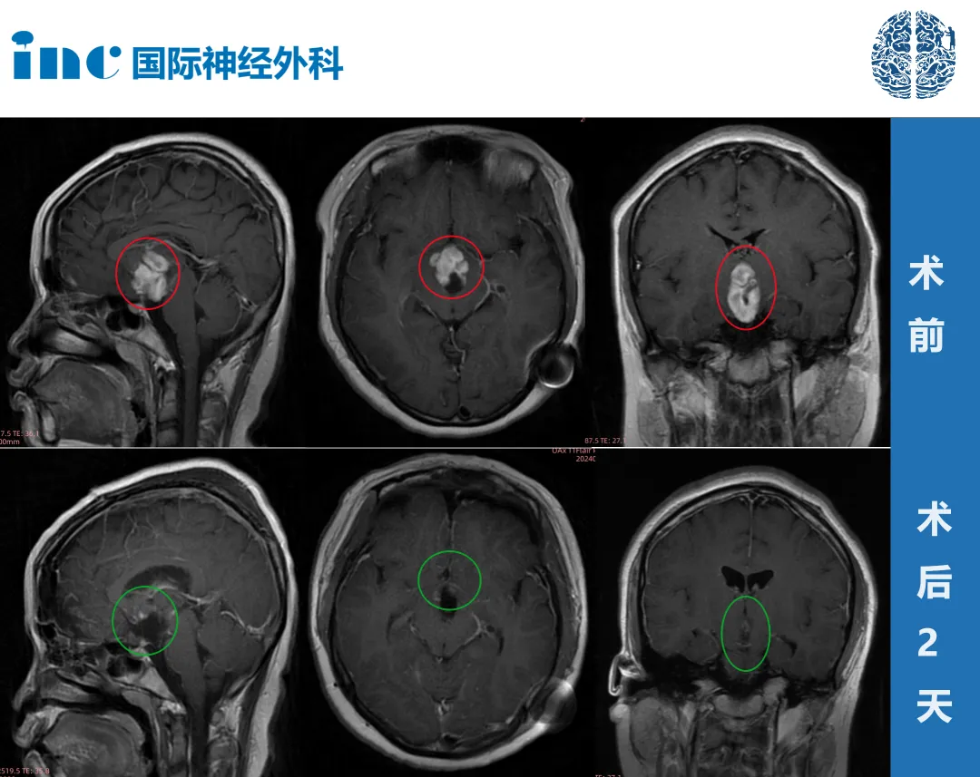 影像