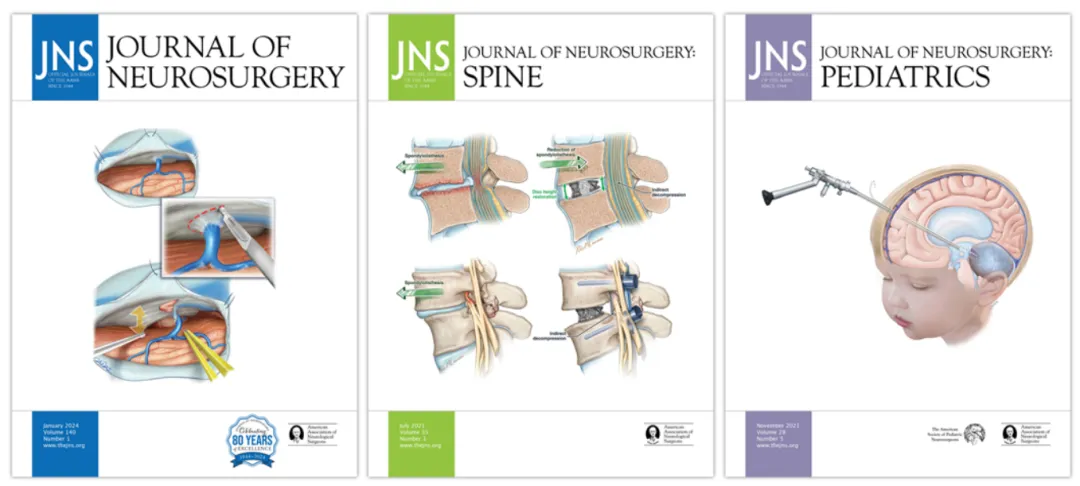 图3.JNS、JNS：脊柱和JNS
