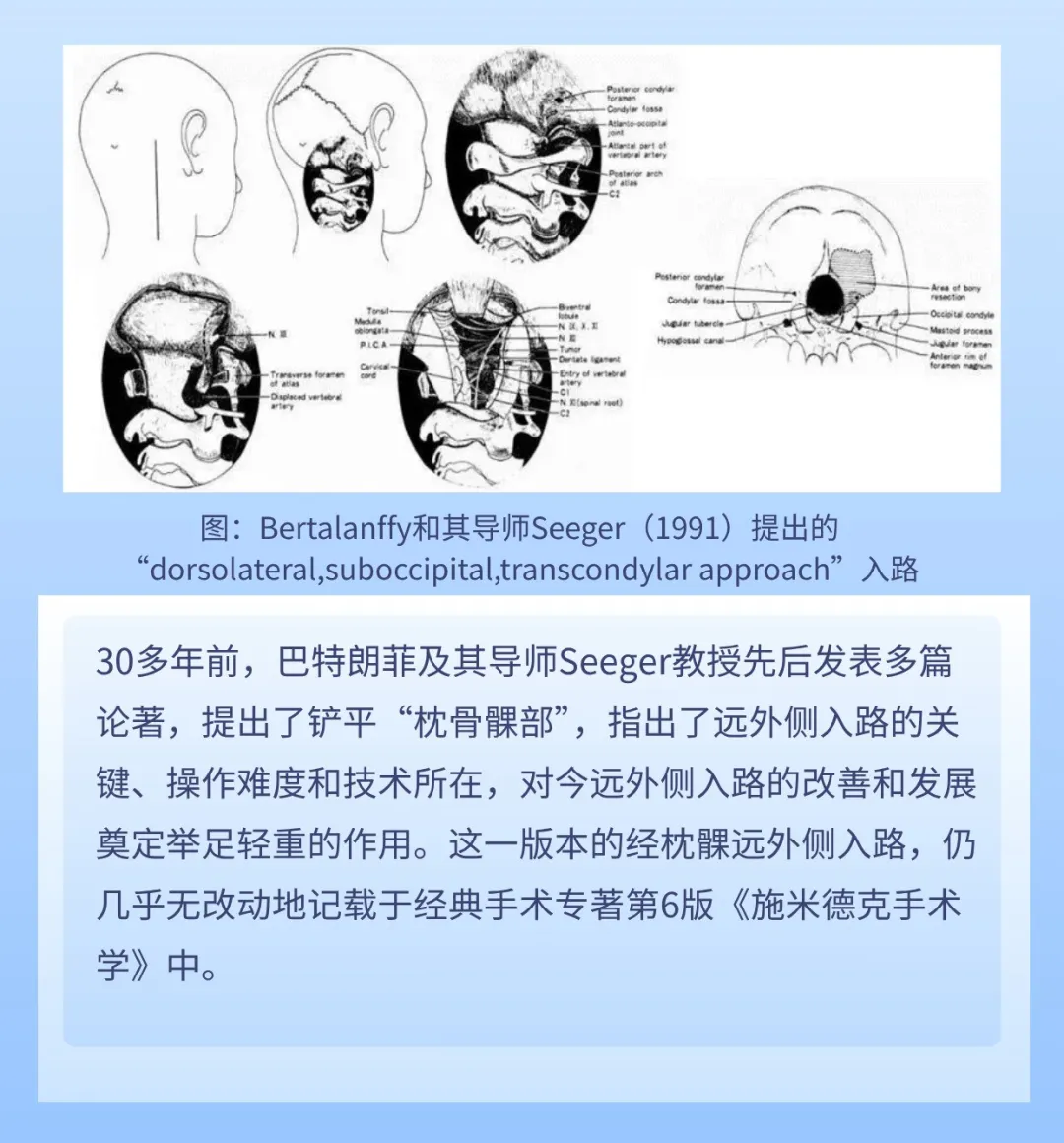枕骨大孔区脑膜瘤与远外侧入路