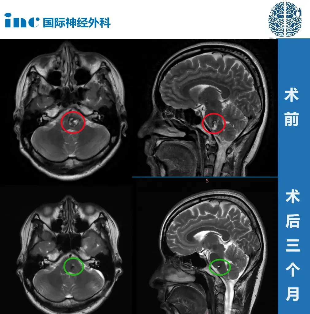 案例