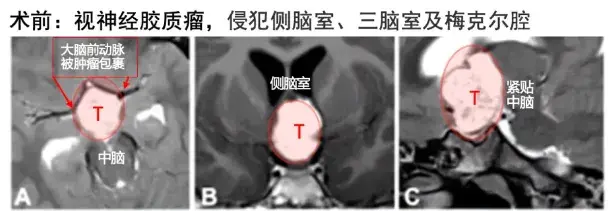 影像