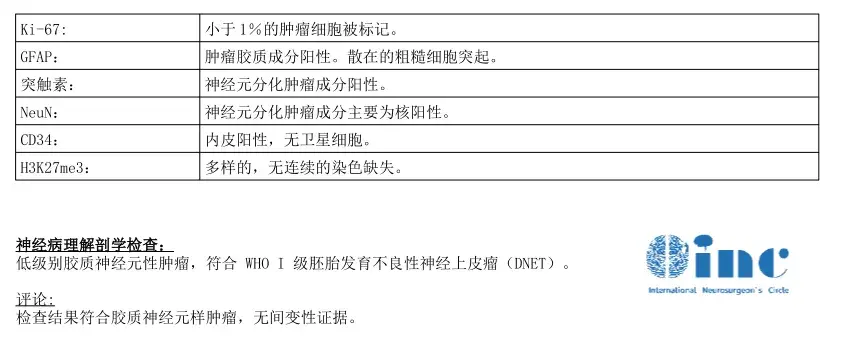 小磊的术后病理报告——预后良好的低级别胶质瘤
