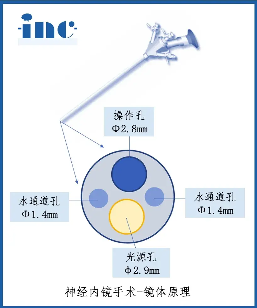 内镜
