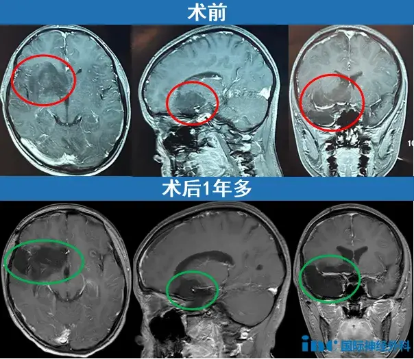 术前术后