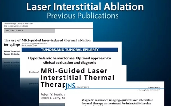LITT治疗难治性癫痫的4大好处